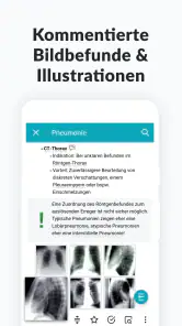 AMBOSS Wissen für Mediziner screenshot
