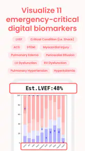 ECG Buddy | ECG Analysis AI screenshot