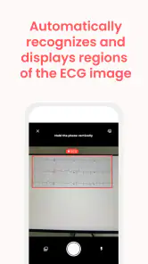 ECG Buddy | ECG Analysis AI screenshot