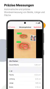 imitoWound - Wunddokumentation screenshot