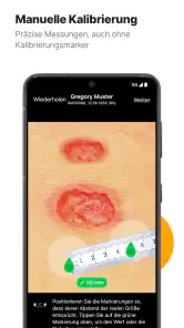 imitoWound - Wunddokumentation screenshot