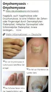 Model Dermatol – Hautkrankheit screenshot
