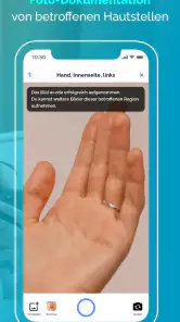 Neurodermitis App Nia screenshot