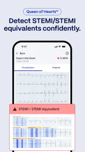 PMcardio for Individuals screenshot