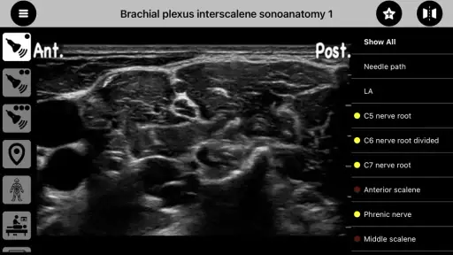 AnSo Anaesthesia Sonoanatomy screenshot