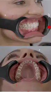 Dental Shooting screenshot