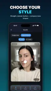 Nose Job - Plastic Surgery AI screenshot