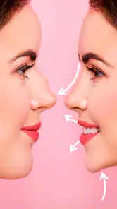 Rhinoplasty App: Nose Editor screenshot