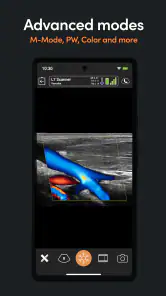 Aplicación ultrasonido Clarius screenshot