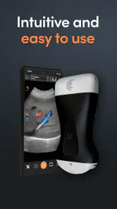 Aplicación ultrasonido Clarius screenshot