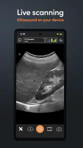 Aplicación ultrasonido Clarius screenshot