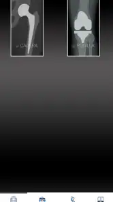 Mi prótesis screenshot
