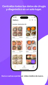 MicroREC App screenshot