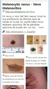 ModelDerm–Enfermedades la piel screenshot