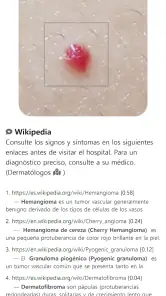 ModelDerm–Enfermedades la piel screenshot