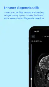 Philips MR Imaging screenshot