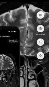 Philips MR Imaging screenshot