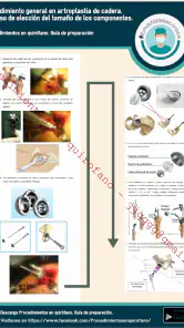 Procedimientos en quirófano screenshot