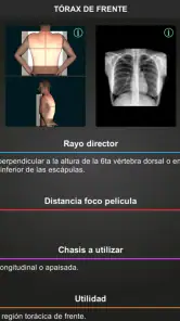 RX - Posiciones Radiológicas screenshot
