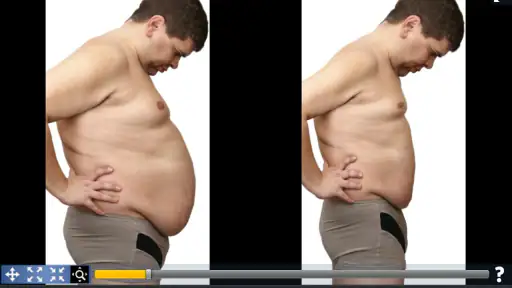Simulador de Cirugía Plástica screenshot