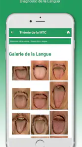 Shen-Acupuncture screenshot