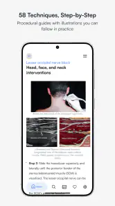 Ultrasound Pain screenshot