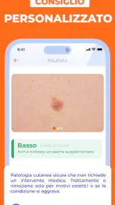 Scanner Pelle IA: Salute & Nei screenshot