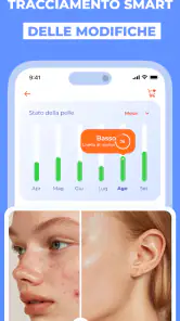Scanner Pelle IA: Salute & Nei screenshot