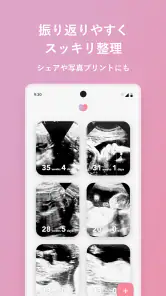エコー写真　スキャンして簡単整理！ screenshot