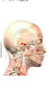 Acupuncture Assistant screenshot