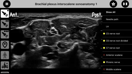 AnSo Anaesthesia Sonoanatomy screenshot