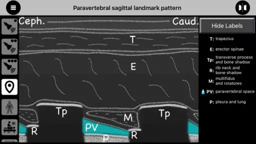 AnSo Anaesthesia Sonoanatomy screenshot
