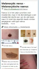 Model Dermatol – Huidziekte screenshot
