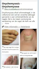 Model Dermatol – Huidziekte screenshot