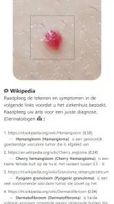 Model Dermatol – Huidziekte screenshot