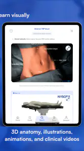 NYSORA Nerve Blocks screenshot