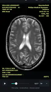 DICOM Viewer screenshot