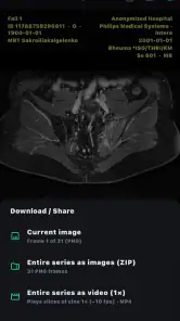 DICOM Viewer screenshot