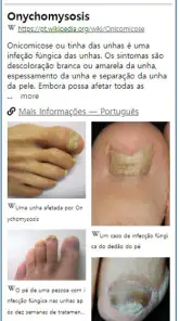 Model Dermatol– Doença de pele screenshot