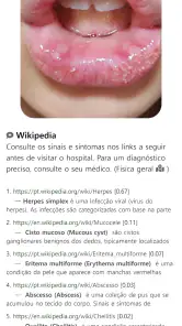 Model Dermatol– Doença de pele screenshot