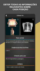 RX - Radiologia Posicionamento screenshot