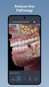 VOKA 3D Anatomy & Pathology screenshot